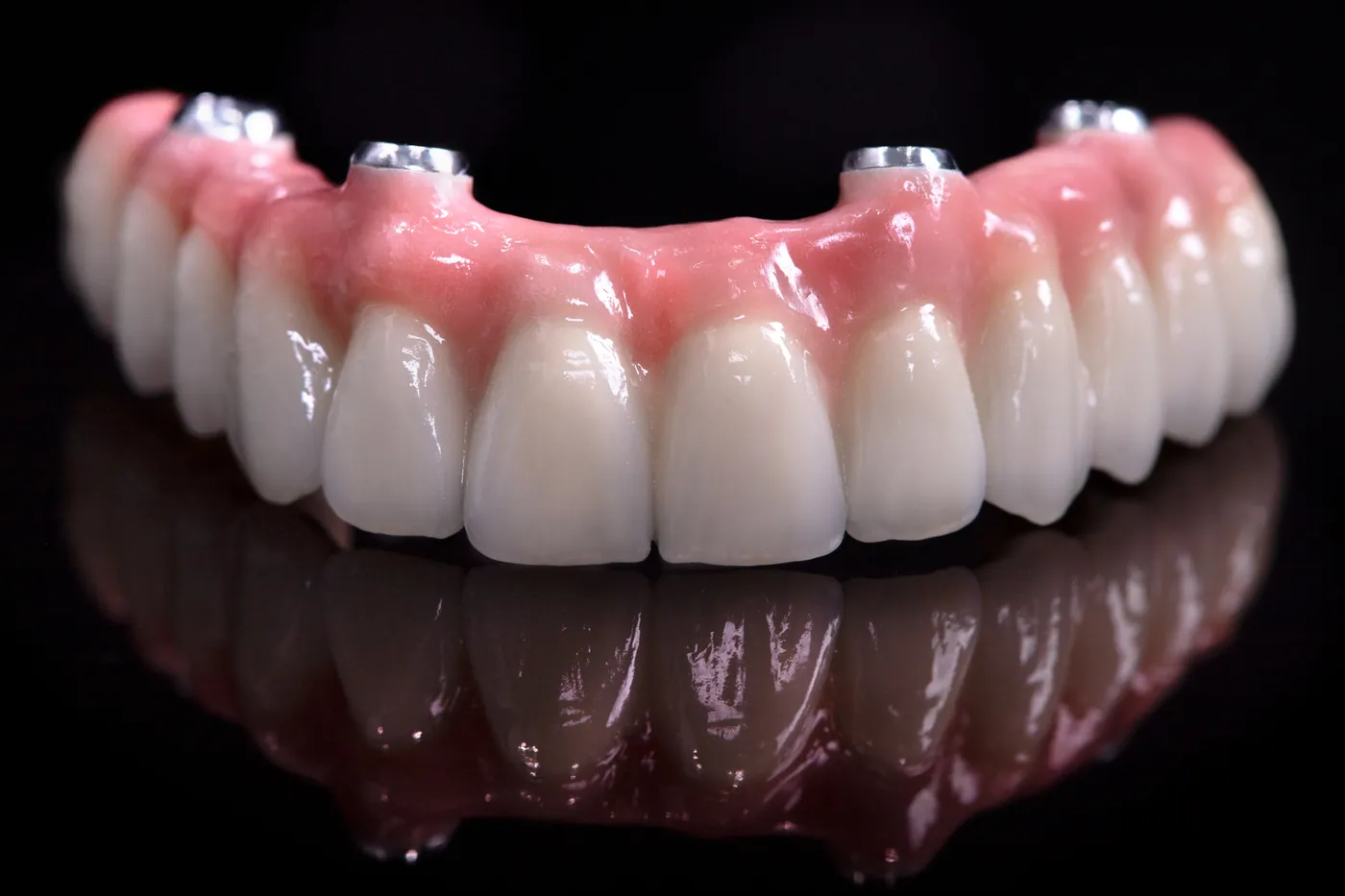 A full-arch fixed dental prosthesis: a complete upper arch of natural-looking teeth and gum-colored base, with metal screw-access points, on a black reflective surface